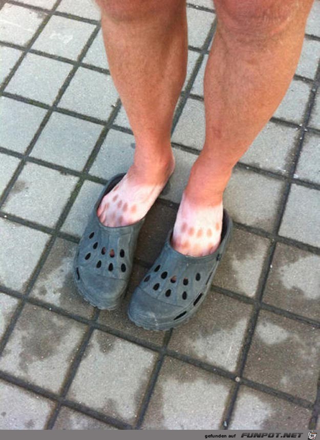 This-person-who-wore-these-Crocs-for-this-long This-person-who-wore-these-Crocs-for-this-long