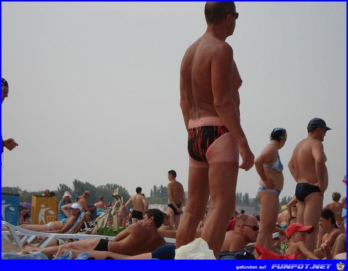 Sonnenbrand Sonnenbrand