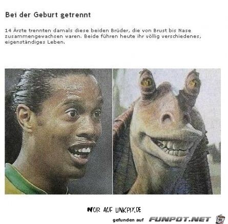 bei der Geburt getrennt bei der Geburt getrennt