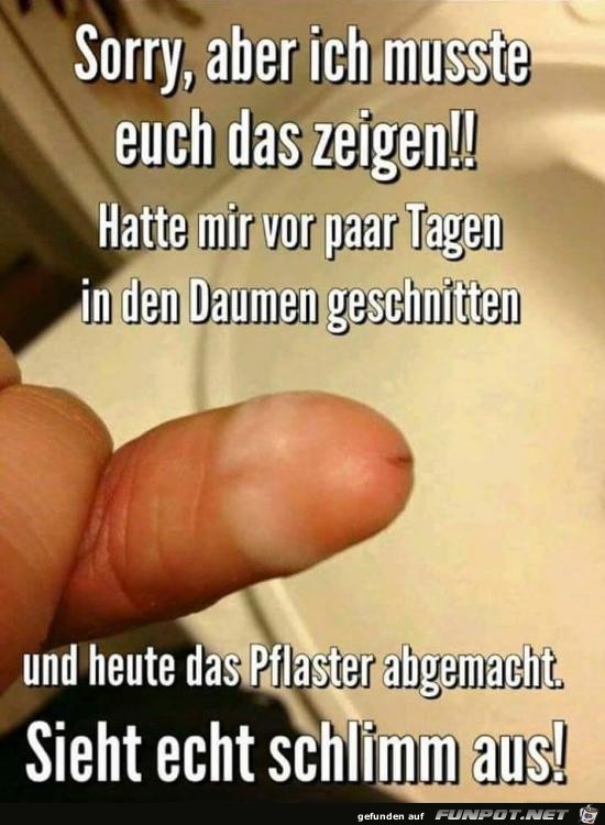 verletzt..... verletzt.....
