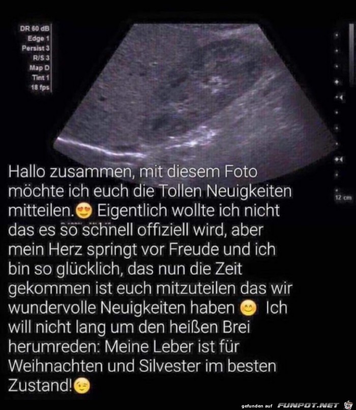 Tolle Neuigkeit Tolle Neuigkeit