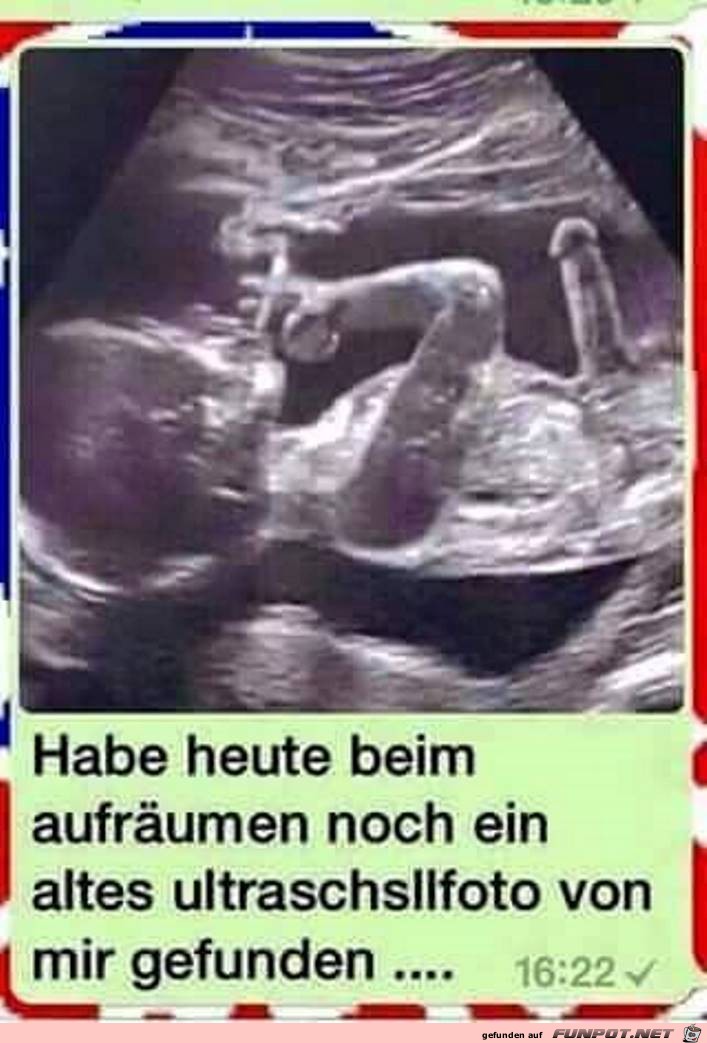 Ultraschallfoto Ultraschallfoto