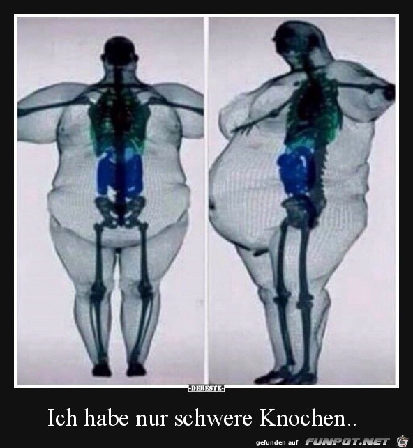 Schwere Knochen Schwere Knochen