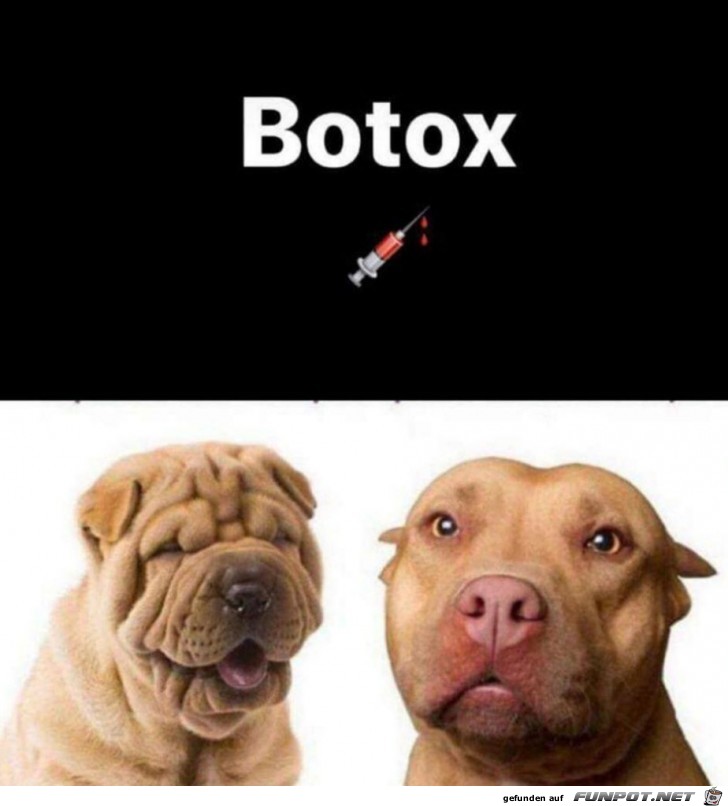 Botox Botox