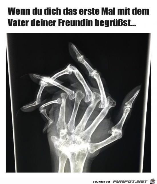 Autsch Autsch