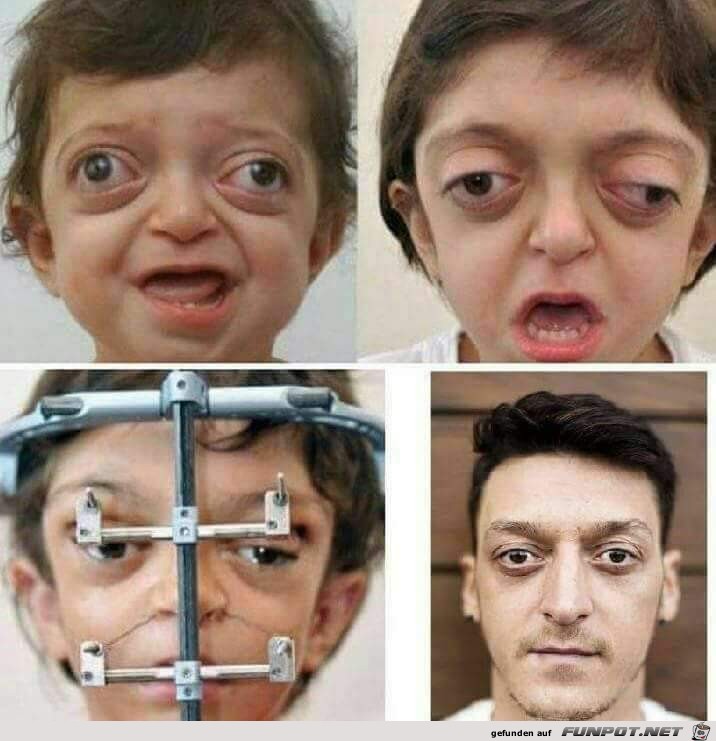 Oezil Oezil