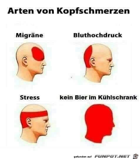 Arten von Kopfschmerzen Arten von Kopfschmerzen