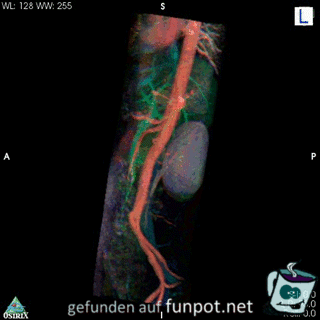 3-D Bild von Menschliche Innereien 3-D Bild von Menschliche Innereien