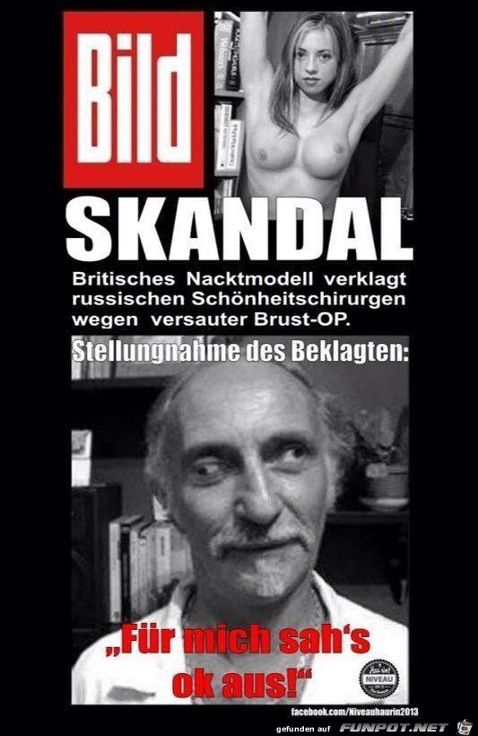 SKANDAL