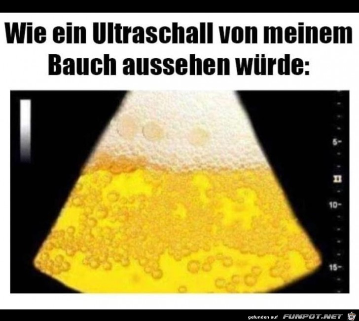 Bierbauch