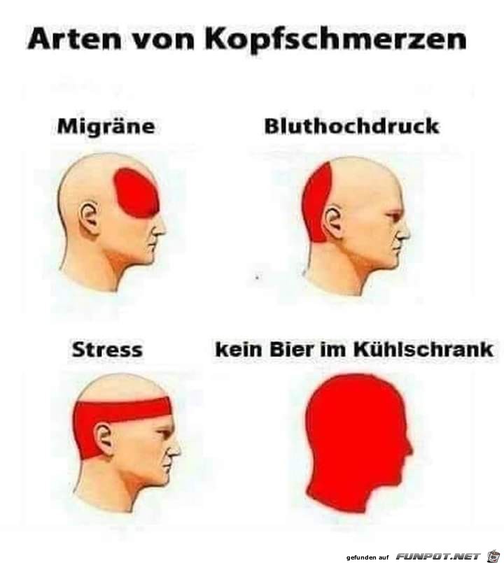 Kopfweh Kopfweh