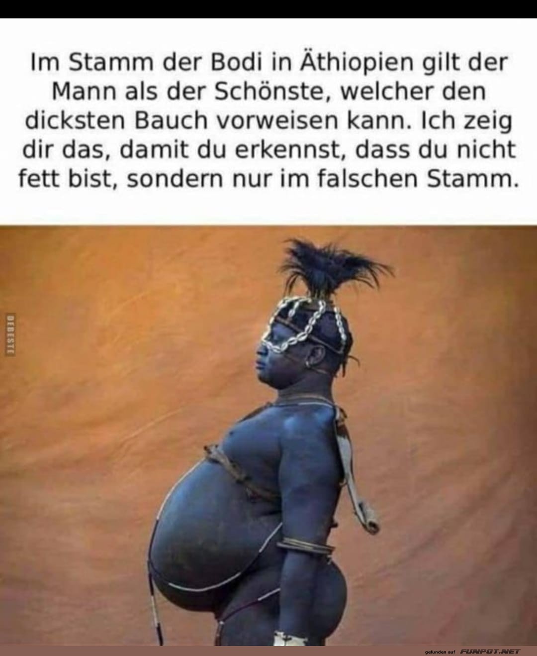 dicker Bauch