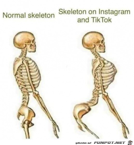 Unterschied im Skelett