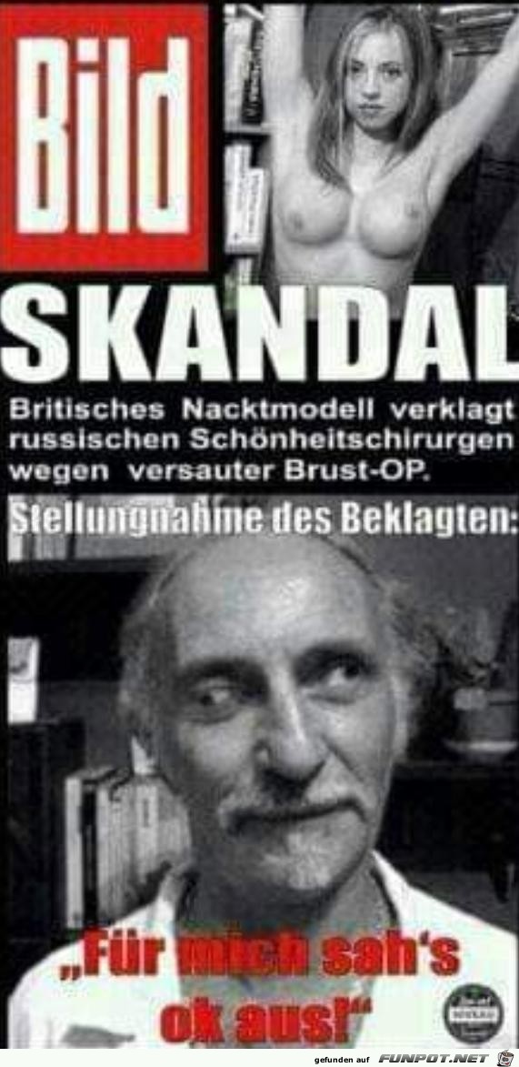 SKANDAL