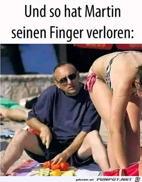 Und der Finger ist ab