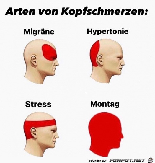 Arten von Kopfschmerzen