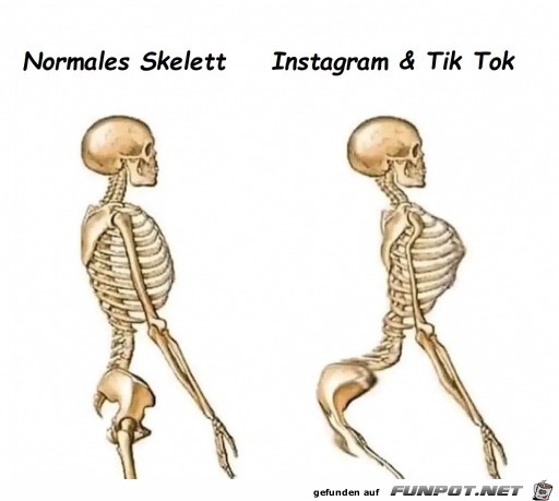 Unterschiedliches Skelett