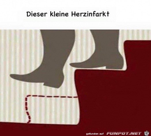 Kleiner Herzinfarkt