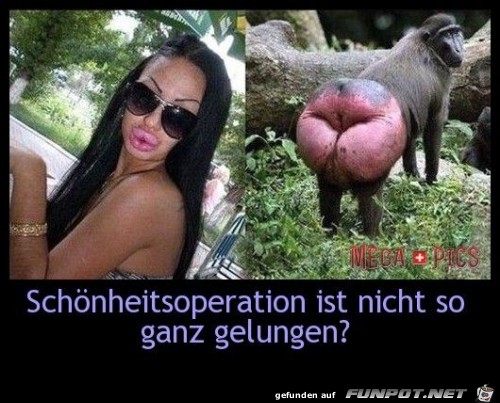 Schnheitsoperation