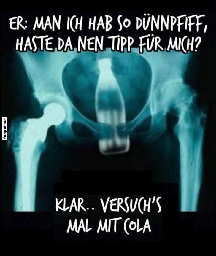 Lustiges Rntgenbild mit Cola-Flasche