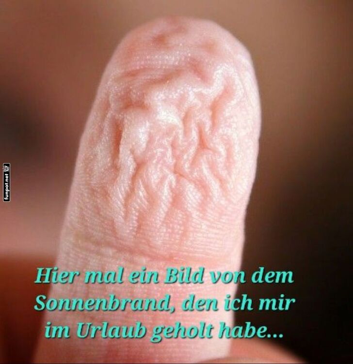 Fingersonne: Der neue Urlaubstrend! Fingersonne: Der neue Urlaubstrend!
