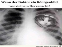 R�ntgenbild vom Herz