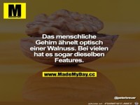 das menschl Gehirn