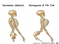 Unterschiedliches Skelett