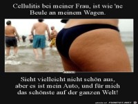 Cellulitis bei meiner Frau...