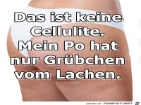 Cellulite