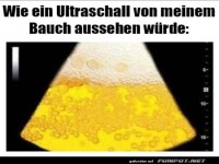 Bier-Bauch-Sonografie: Klare Diagnose!
