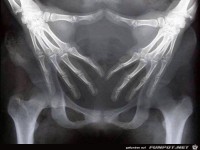 Rntgenbild von Angela Merkel