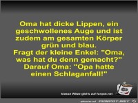 Oma hat dicke Lippen, ein geschwollenes Auge und ist zudem
