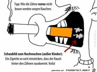 Was gegen gelbe Raucherzhne hilft