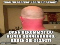 Kein Sonnenbrand, oder doch ?
