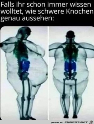 Schwere-Knochen.jpg auf www.funpot.net