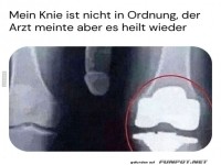 Rntgenbild mit humorvollem Kommentar