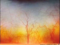 ist ein Teil vom Augapfel