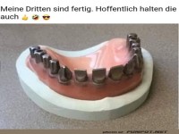 Upgrade f�r die dritten Z�hne?