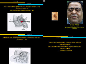 Prostatauntersuchung