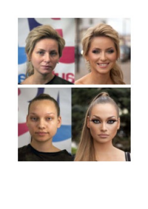 Vorher - Nachher